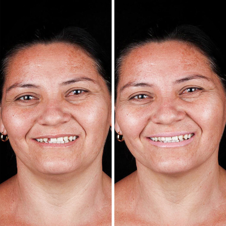 Бразильский дантист-альтруист ездит по всему миру, чтобы дарить людям новые улыбки — бесплатно!