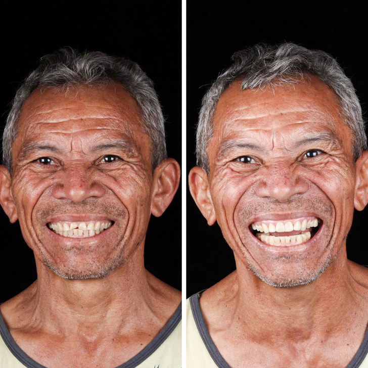Бразильский дантист-альтруист ездит по всему миру, чтобы дарить людям новые улыбки — бесплатно!