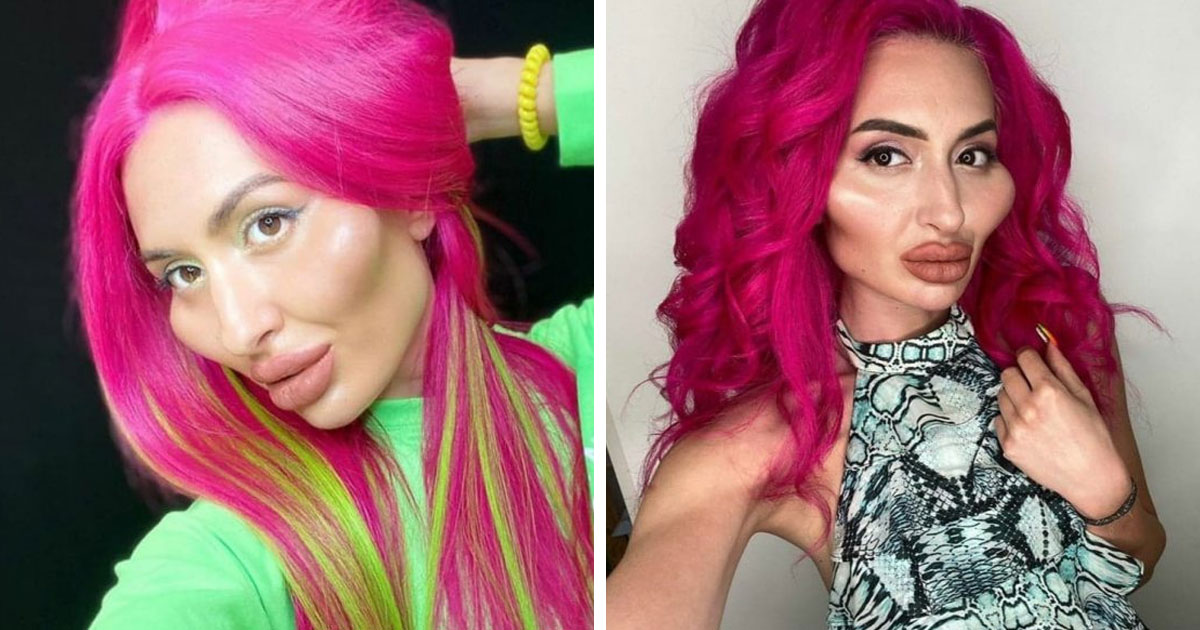 блогерша анастасия покрищук. покрищук до и после пластики. покрищук до и после пластики. покрищук до и после пластики. анастасия покрищук.