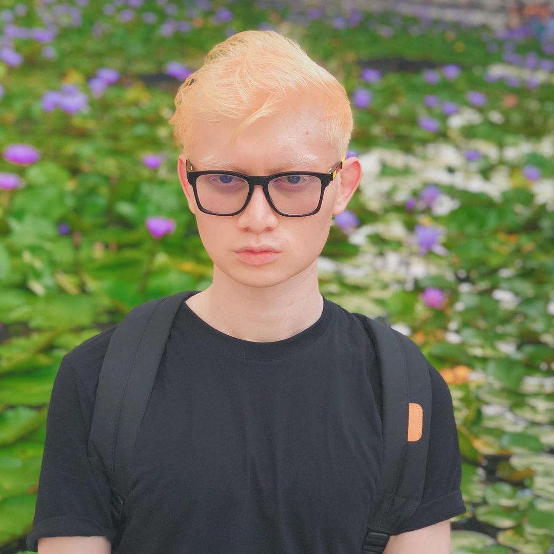 Белоснежная особенность : 19 фотоснимков людей с альбинизмом, доказывающих, что это красиво